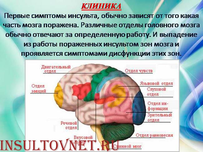Поражение левого полушария мозга. Инсульт зоны поражения головного мозга. Инсульт долей головного мозга.