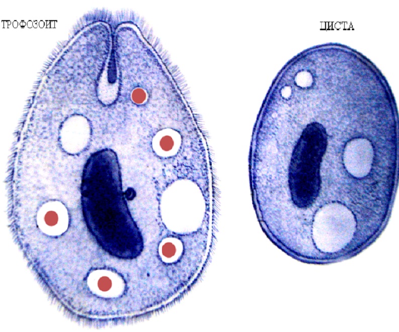 Два вида лямбли: трофозоид и циста