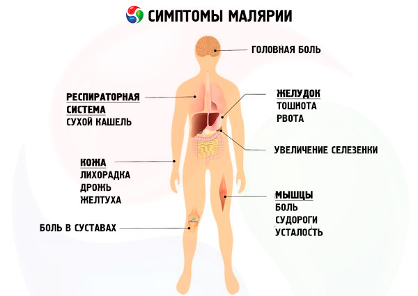 симптомы малярии у человека