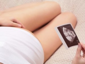 Можно ли беременным применять пластырь перцовый