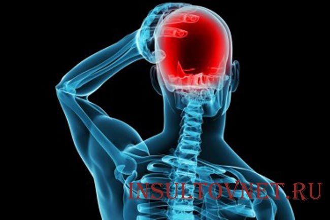 Симптомы абузусной головной боли