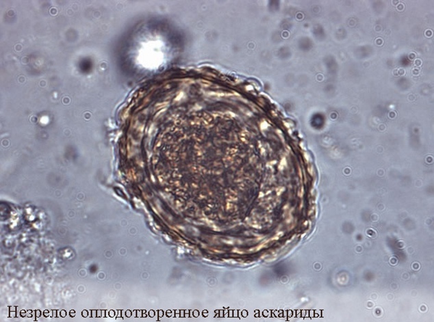 яйцо аскариды под микроскопом