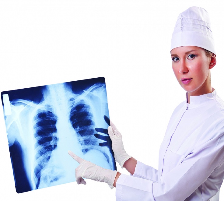 Рентгенограмма грудной клетки дает оценить степень поражение легких при токсокарозе