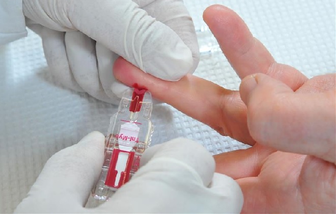 анализ крови из пальца