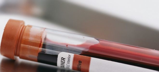 Анализ крови на токсокароз