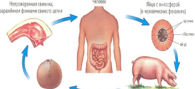 Симптомы, диагностика и лечение свиного цепня
