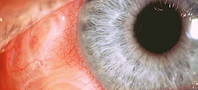 Симптомы и лечение паразитов в глазах человека