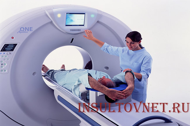 Рентгеновское сканирование головного мозга