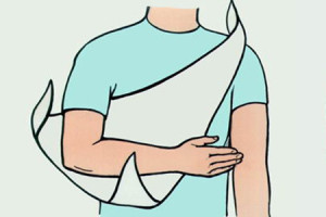 Травмированное плечо фиксируем повязкой 
