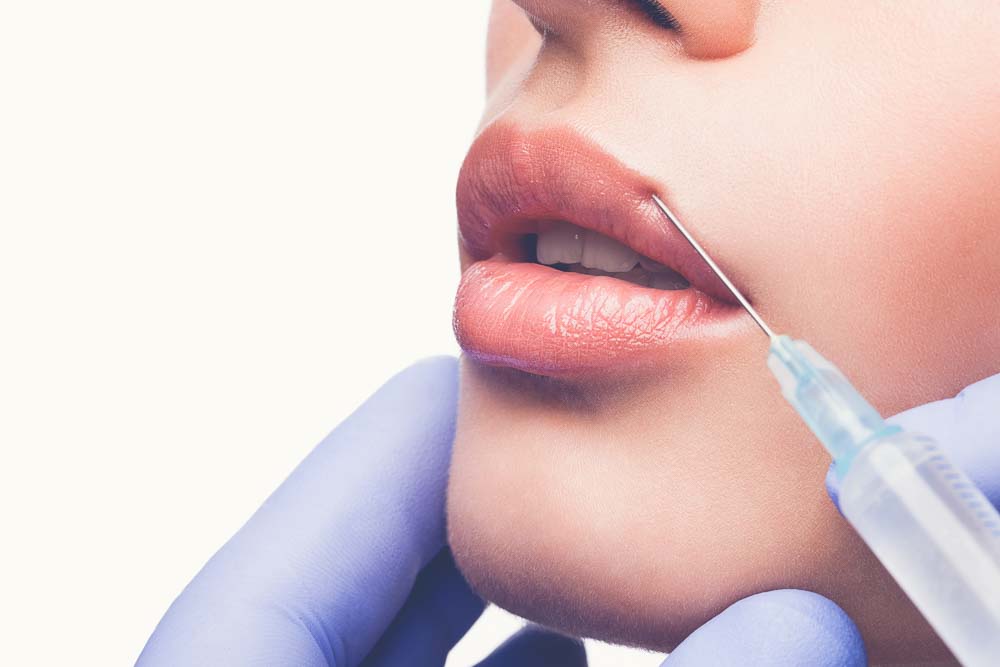 Увеличение губ ботоксом: стоимость процедуры, противопоказания, отзывы, последствия инъекций